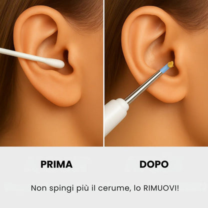 Ritrova subito un’udito chiaro e sicuro